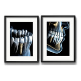 2 Quadros Dentista Implantes Endodontia Clínica Rs1 Paspatur