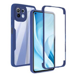 Capa Para Xiaomi Mi 11t Pro Lite 360 Paquetes Completos