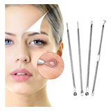 Kit De Remoção De Cravos E Acne, Extrator De Cravos, 4 Unidades