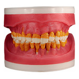 Refil De Cirurgia Com Dentes De Periodontia Ac025 - Pronew