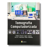 Tomografia Computadorizada + Brinde 